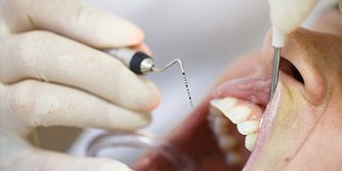 Treatment of periodontal disease