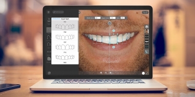 Digital Smile Design