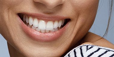 Tooth whitening