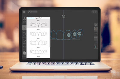 Digital Smile Design