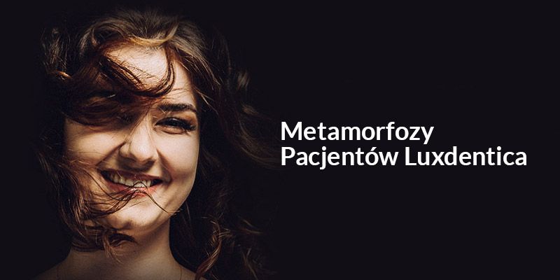 Metamorfozy Pacjentów Luxdentica