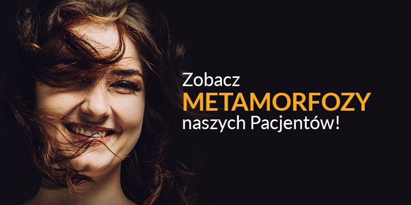 Metamorfozy naszych Pacjentów