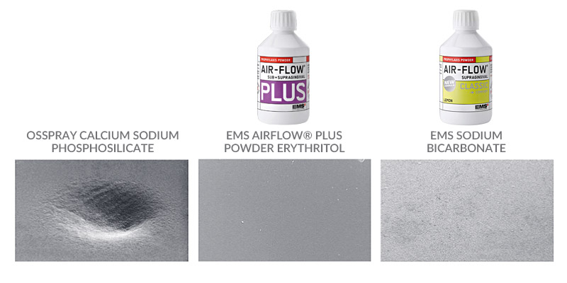 The effect of air polishing on human enamel after 5 seconds.