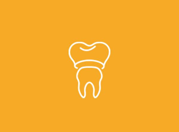 Smart m PRO Laser in Prosthodontics