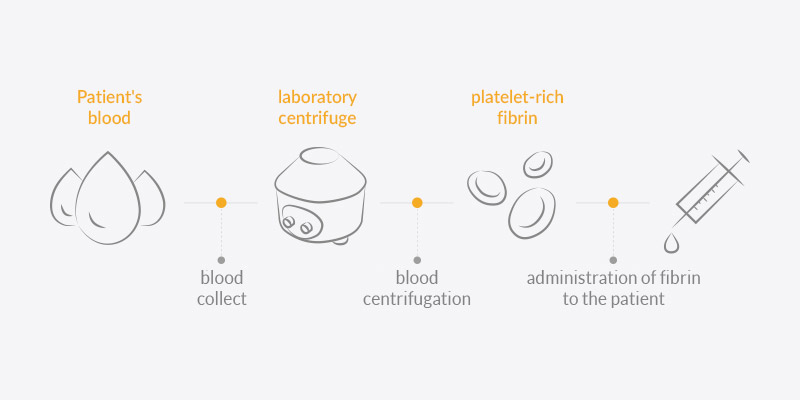 Fibryna bogatopłytkowa - procedura zabiegu w Luxdentica